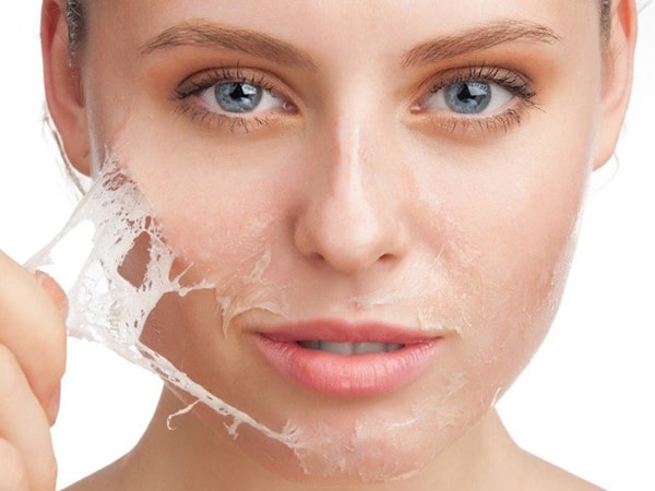 Nguyên nhân da mặt sần sùi - Cách hô biến da trắng mịn nhanh chóng